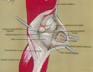 Illustration of left knee, medial view, showing bones, tendons, muscles, meniscus and ligaments with the medial patellar retinaculum retracted