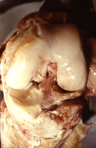 Natural color photograph of dissection of the knee, anterior view