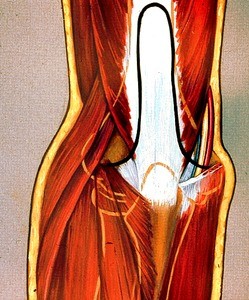 Illustration of left elbow region, posterior view, showing ulnar artery and nerve, with humerus, radius and ulna ghosted in, and black line (indicating surgical incision) in relation to triceps tendon