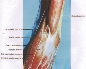 Natural color photograph of dissection of right cubital region, antero-medial aspect, showing major superficial muscles of the forearm