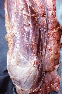 Natural color photograph of dissection of the right knee, medial view