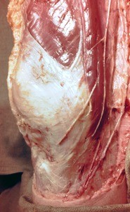 Natural color photograph of dissection of the right knee, medial view, with the skin removed to reveal fascia, muscles, and nerves