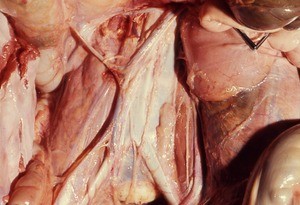 Natural color photograph of dissection of the abdomen, anterior view, showing the posterior body wall, with the viscera retracted