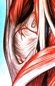 Illustration of dissected right knee joint, medial view, showing the joint capsule, the semi-membranosus m., medial gastrocnemius m.(reflected), and popliteus m.; popliteal a. and its genicular branches, and sciatic nerve bifurcating to form the tibial n. & common fibular (peroneal) nerve