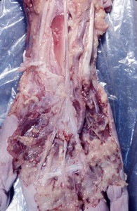 Natural color photograph of dissection of the right hand, anterior view, showing muscles, nerves and vasculature