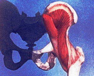 Illustration of dissection of iliopsoas muscle of left thigh