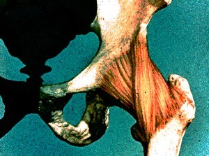 Illustration showing anterior view of left hip joint, emphasizing iliofemoral and pubofemoral ligaments