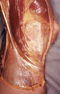 Natural color photograph of dissection of the left knee, anterior view