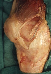 Natural color photograph of dissection of the right knee, medial view