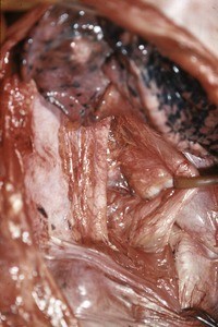 Natural color photograph of dissection of the thorax, anterolateral view, showing the thoracic surface of the diaphragm