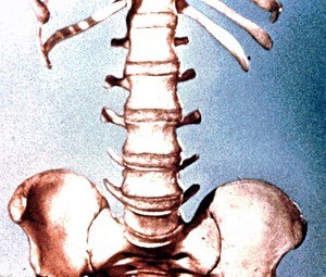 Illustration of skeleton of posterior abdominal wall and pelvis: lower ribs, lumbar vertebrae and intervertebral disks, sacrum and ilia