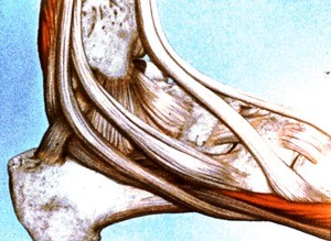 Illustration of dissection of tendons of right ankle, lateral view