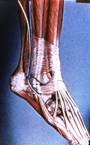 Illustration of dissection of right shin, ankle and foot, anterolateral view