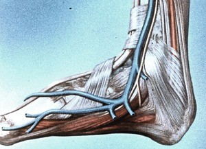 Illustration of dissection of right ankle and foot, medial aspect, emphasizing great saphenous vein; also shown: abductor hallucis muscle & flexor digitorum brevis