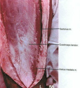 Natural color photograph of superficial dissection of the right anterior thigh