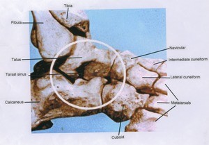 Illustration of dissection of the bones of the right ankle joint, lateral view