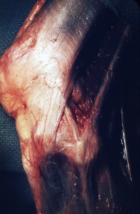 Natural color photograph of dissection of the left knee, lateral view