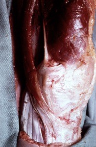 Natural color photograph of dissection of the left knee, medial view, showing muscles and tendons