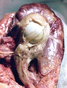 Natural color photograph of dissection of the left shoulder, superior view, with the deltoid muscle reflected and glenohumeral joint capsule opened to reveal the tendon of the long head of the biceps brachii muscle running over the head of the humerus