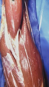 Natural color photograph of dissection of the left cubital fossa, anterior view