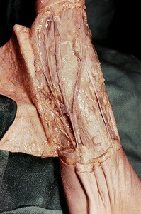 Natural color photograph of dissection of the arm and forearm, showing venous structures