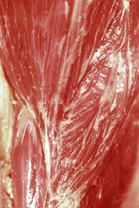 Natural color photograph of dissection of the left shoulder, lateral view, with the skin removed to expose the muscle structure