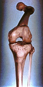 Illustration of articulated femur (entire), tibia and fibula of the left lower limb. Note: patella is absent; femur is flexed relative to tibia (anterior view)