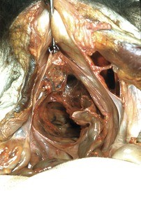 Natural color photograph of dissection of the pelvic cavity, superior view, showing the viscera and associated mesentery