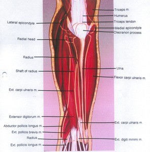 Illustration of dissection of the left forearm, posterior view, showing the extensor musculature and the underlying bones