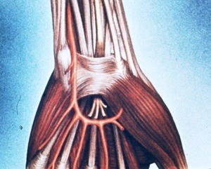 Illustration of dissected left hand, showing the superficial palmar arterial arch in relation to, esp. thenar and hypothenar muscles, superficial flexor digital mm-tendons, palmar carpal ligament, median nerve