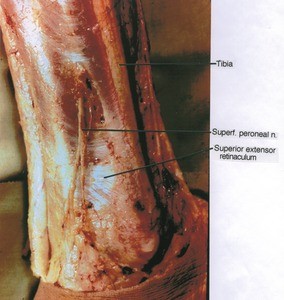 Natural color photograph of left leg, medial view, showing ligament, nerves and bone