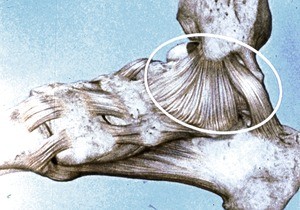 Illustration of right ankle, medial view, emphasizing deltoid ligament