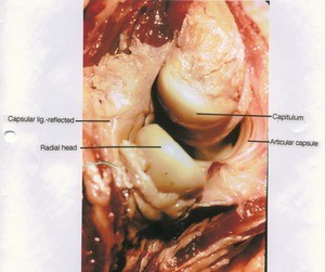 Natural color photograph of dissection of the elbow joint, lateral view