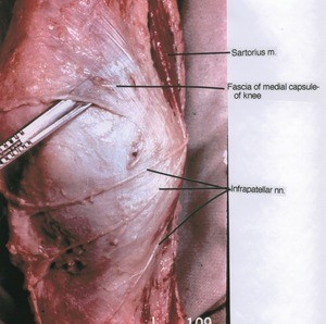 Natural color photograph of right knee, anterior view, showing muscle, nerves and fascia of medial capsule