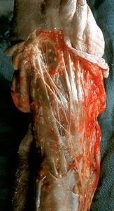 Natural color photograph of dissection of the dorsal surface of the right foot