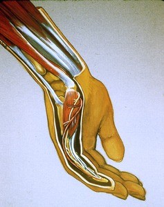 Illustration of semi-dissected left forearm, wrist and hand, wrist in semi extension; medial aspect; showing finger flexor muscle, ulnar carpal flexor & extensor muscles; abd. dig.-V m., ulnar proper digital artery and ulnar proper digital nerve