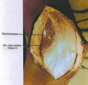 Natural color photograph of left elbow, lateral view, showing muscles