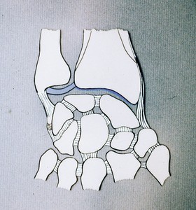 Illustration of bones of left hand and wrist: radius. ulna, carpals; and bases of metacarpals & interosseous ligaments (semidiagramatic), palmar view
