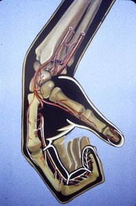 Illustration of bones of right hand, semi clenched, in relation to skin, and with blood (and nerve) supply of first and second digits (from radial & ulnar arteries)