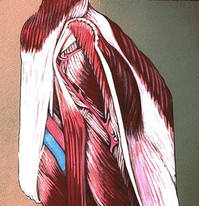 Illustration of partially dissected left thigh, with the tensor fasciae latae muscle reflected laterally to bare deeper structures, e.g., pectineus m., lateral femoral circumflex artery and its branches, and iliacus muscle