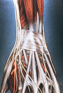 Illustration of dissected left wrist and hand, showing extensor retinaculum, tendons of digital extensors, dorsal digital branches of ulnar and radial artery (dorsal aspect)