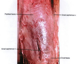 Natural color photograph of knee, posterior view, showing the saphenous veins and crural and popliteal fascia