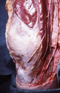 Natural color photograph of dissection of the right knee, medial view, showing musculature and superficial vessels