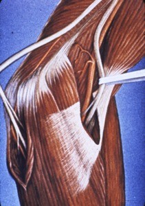 Illustration of left elbow, medial aspect, showing relationships of ulnar and median nerves (re-tracted) as they cross the joint to enter the forearm, and muscles acting across the joint