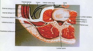 Illustration of crossection of the lower back at the lumbar level, showing the oblique abdominal muscles and the deep and superficial back muscles. Lines indicate position of abdominal viscera and vasculature