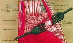 Illustration of the left wrist, anterior view, showing tendons, nerves and arteries