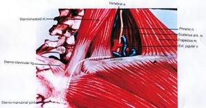 Illustration of lower left portion of neck, anterior view, showing ligament, muscles, bone, nerve, veins and artery