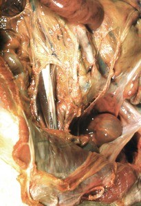 Natural color photograph of dissection of the peritoneal cavity, anterior view, showing abdominal viscera and associated mesentery