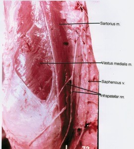 Natural color photograph of lower right thigh and knee, anteromedial view, showing muscles, vein and nerves