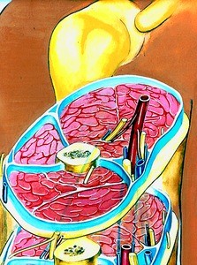 Color illustration of cross section of right arm, showing arteries, veins, nerves, bone and muscles